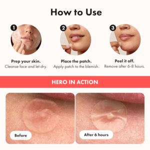 Hero Cosmetics Mighty Patch Original – Hydrocolloid Patch for Pimples, Overnight Acne Blemish & Zit Stickers for Sensitive Skin, 36 Count