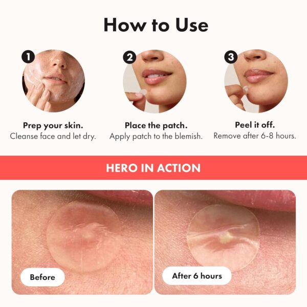 Hero Cosmetics Mighty Patch Original – Hydrocolloid Patch for Pimples, Overnight Acne Blemish & Zit Stickers for Sensitive Skin, 36 Count